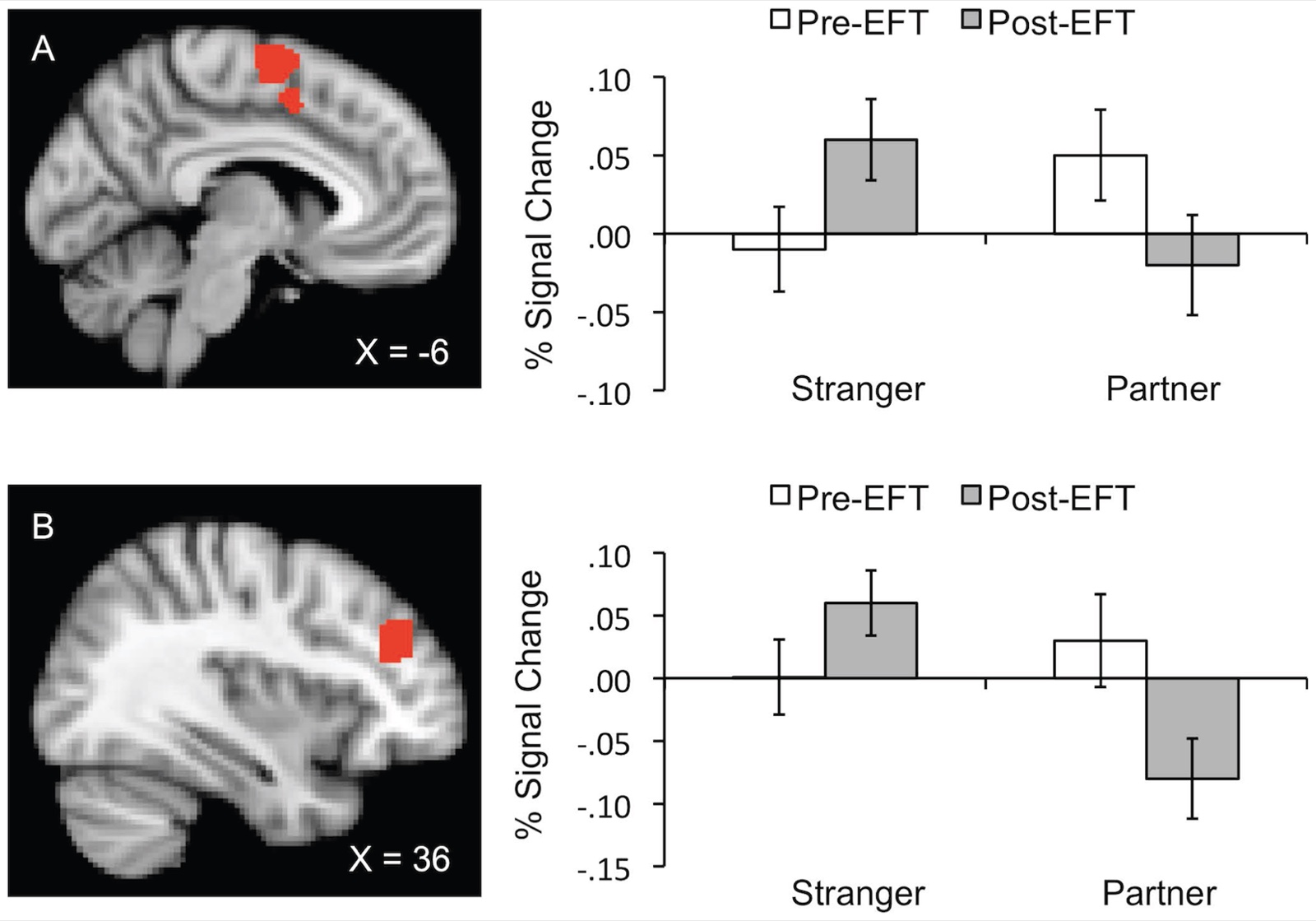 Coupes cérébrales et diagrammes en barres de l’activité du cortex moteur supplémentaire et du CPFdl droit, conditions inconnu et partenaire, avant et après l’EFT